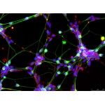 Human Motor Neurons (iPSC-derived, Normal)